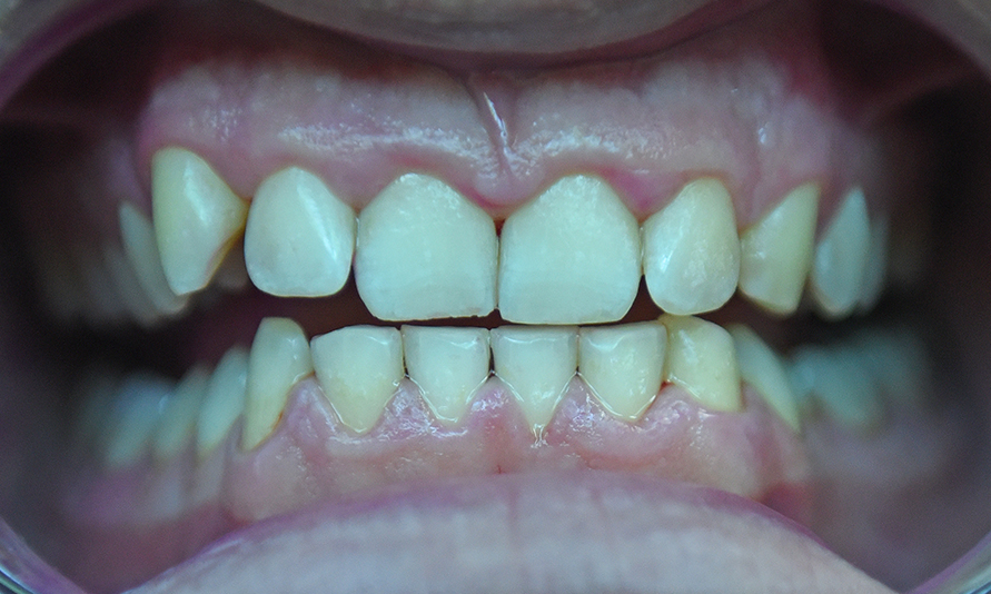 After - Olive Tree Dental